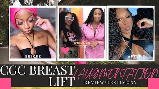 CGCosmetic BREAST LIFT + AUGMENTATION @cgcosmetic BY DR. FREIMAN REVIEW/TESTIMONY!