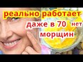 У МЕНЯ Нет Морщин ! Делаю Через День, Лицо Молодеет Даже в 70 ЛЕТ Рецепт