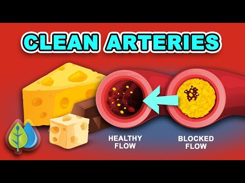10 BEST Foods to Clean Out Your Arteries