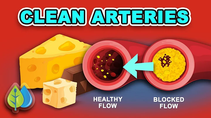 Top 10 Foods that Clean Your Arteries Fast | foods...
