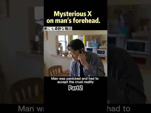 Man found a mysterious X Mark on his forehead.