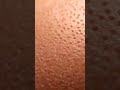 What Happens When This Touches Skin