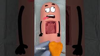 Goodland | Sausage surgery, organ replacement😂 #goodland #Fruitsurgery #doodles #doodlesart #cartoon