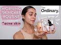 THE ORDINARY FULL WEEK MORNING SKINCARE FOR ACNE PRONE SKIN 💆🏻 (glycolic toner , caffeine  solution)