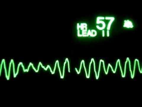 Ventricular Fibrillation ( Eğitim Videosu )
