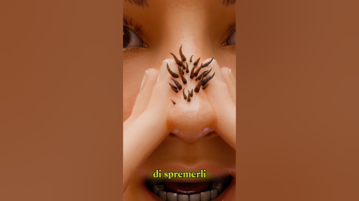 COME RIMUOVERE UN PUNTO NERO (credits: ​⁠@TheOutliners.)