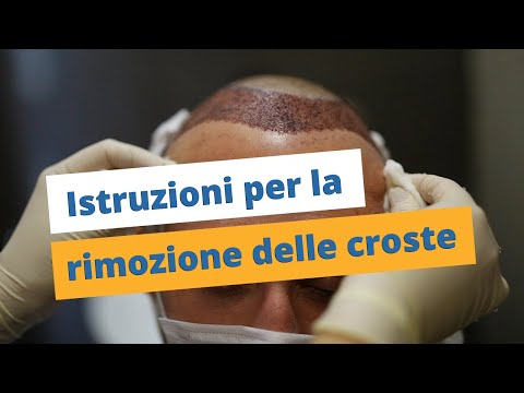 Video: Le croste cadono?