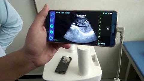 What can I see if I use a BW USB Ultrasound Convex Array Probe