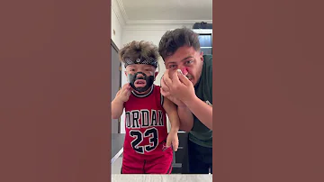 عزات عمل مقلب بي يحيى أنه وجهه تقشر هههههه لا يفوتكم يحيى الزعبي 