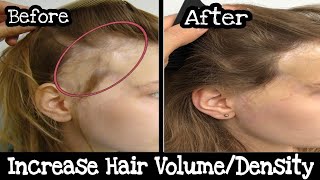 Thin To Thick Hair in Just A week | Reasons For Low Hair Density