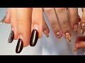 HUGE Transformation on Spoon Nails 😱 Fixing Nails Growing Upward