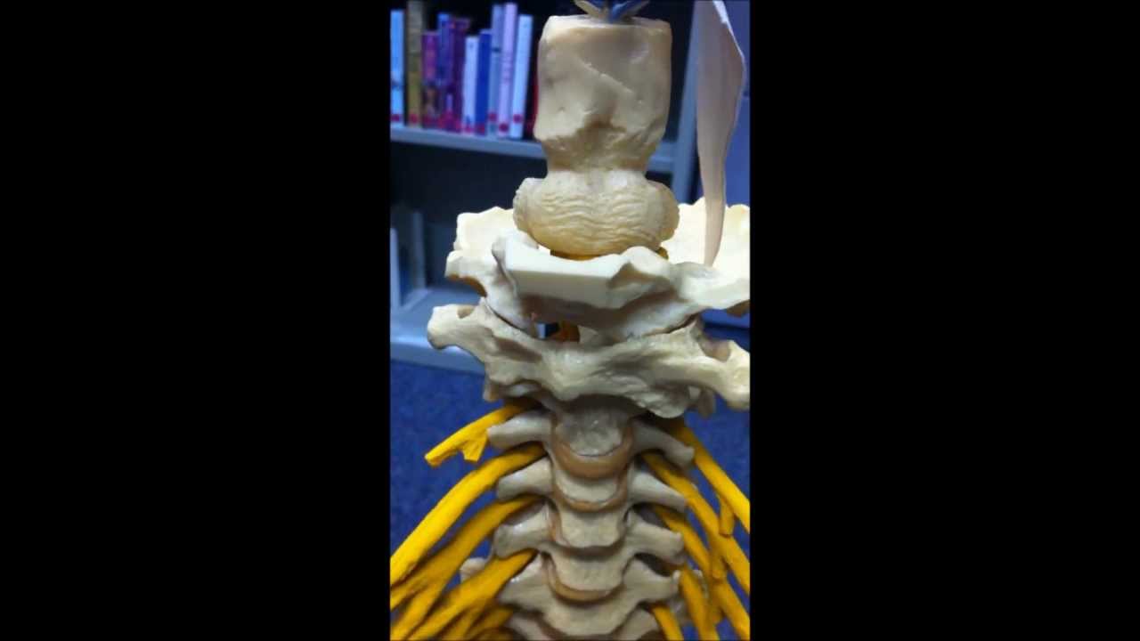 Quick Demonstration Of C1 C2 Instability In Ehlers Danlos Youtube