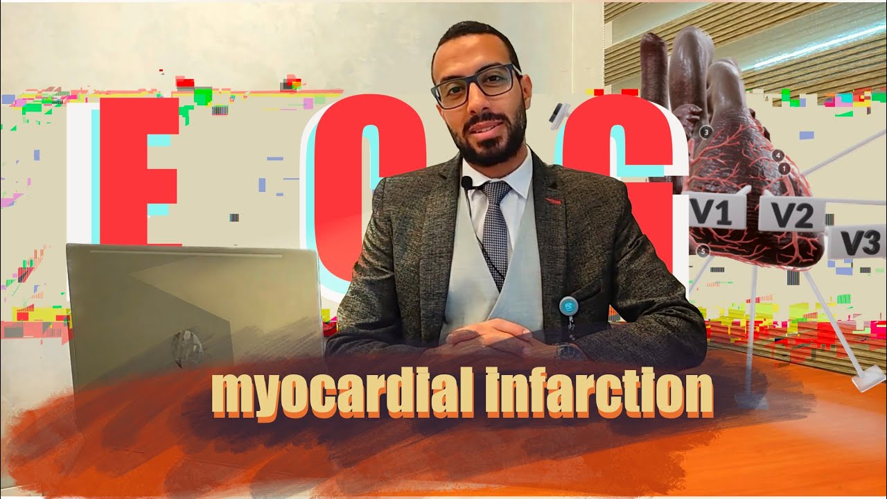 Myocardial Infarction Treatment علاج جلطات القلب