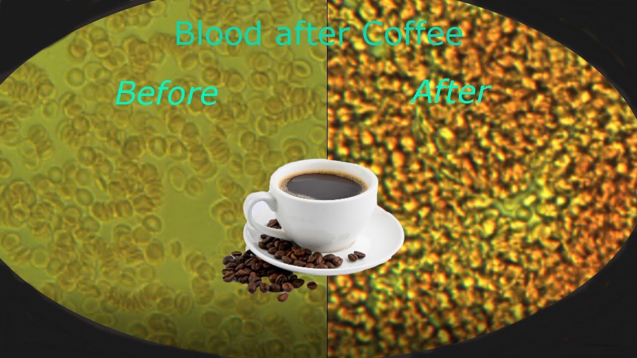 What Happen To Your Blood When You Drink Coffee MUST WATCH YouTube What Happen To Your Blood When You Drink Coffee MUST WATCH YouTube