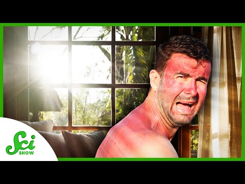 Can You Get a Sunburn Behind a Window?