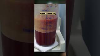 Axillary /armpit boob Surgery | Liposuction