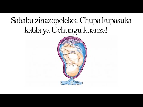 Video: Kwa Nini Forsythia Inakataa Kupasuka?