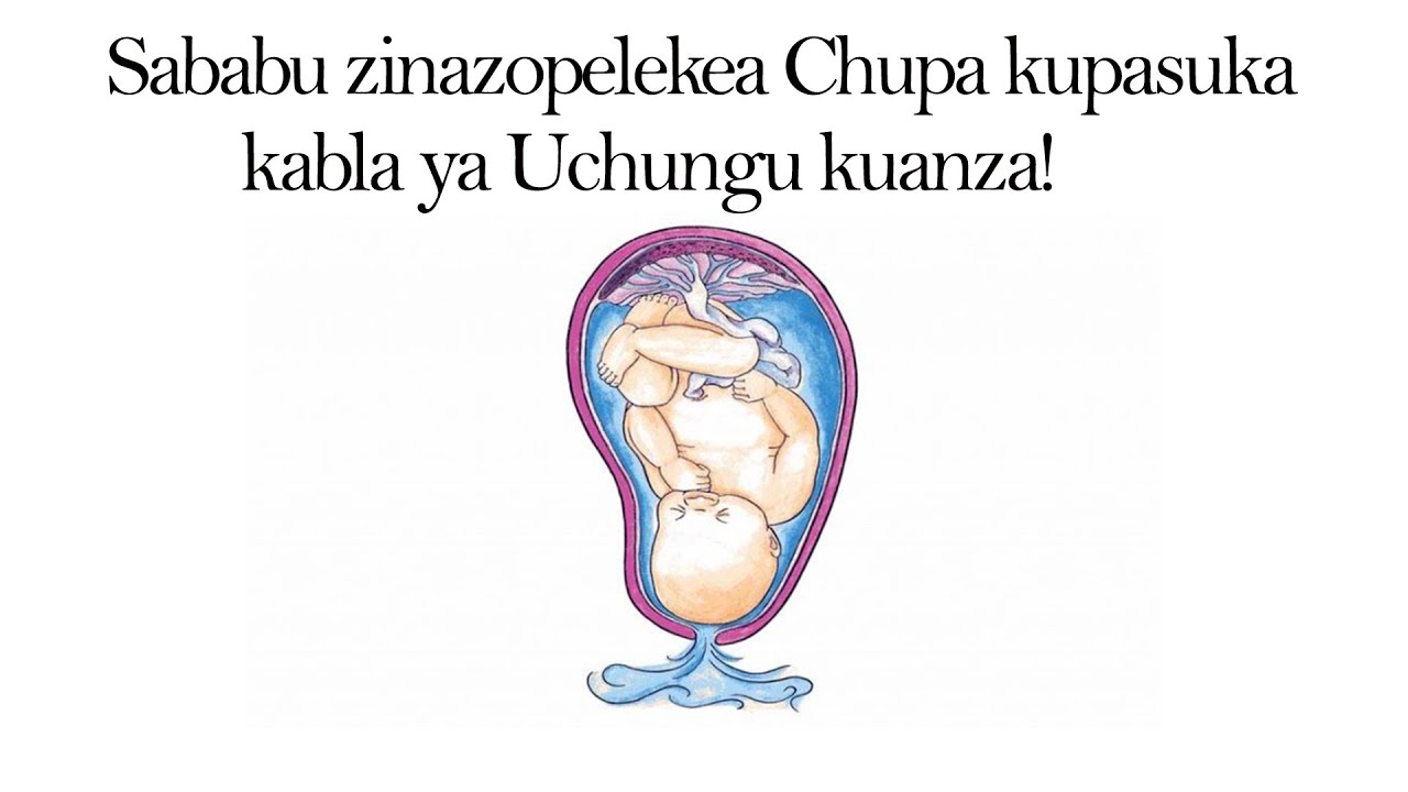 Je kwa nini Chupa hupasuka kabla ya Uchungu kuanza? | Chupa kupasuka kwa Mjamzito kabla ya Uchungu!!