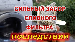 Почему важно чистить сливной фильтр стиральной машины!