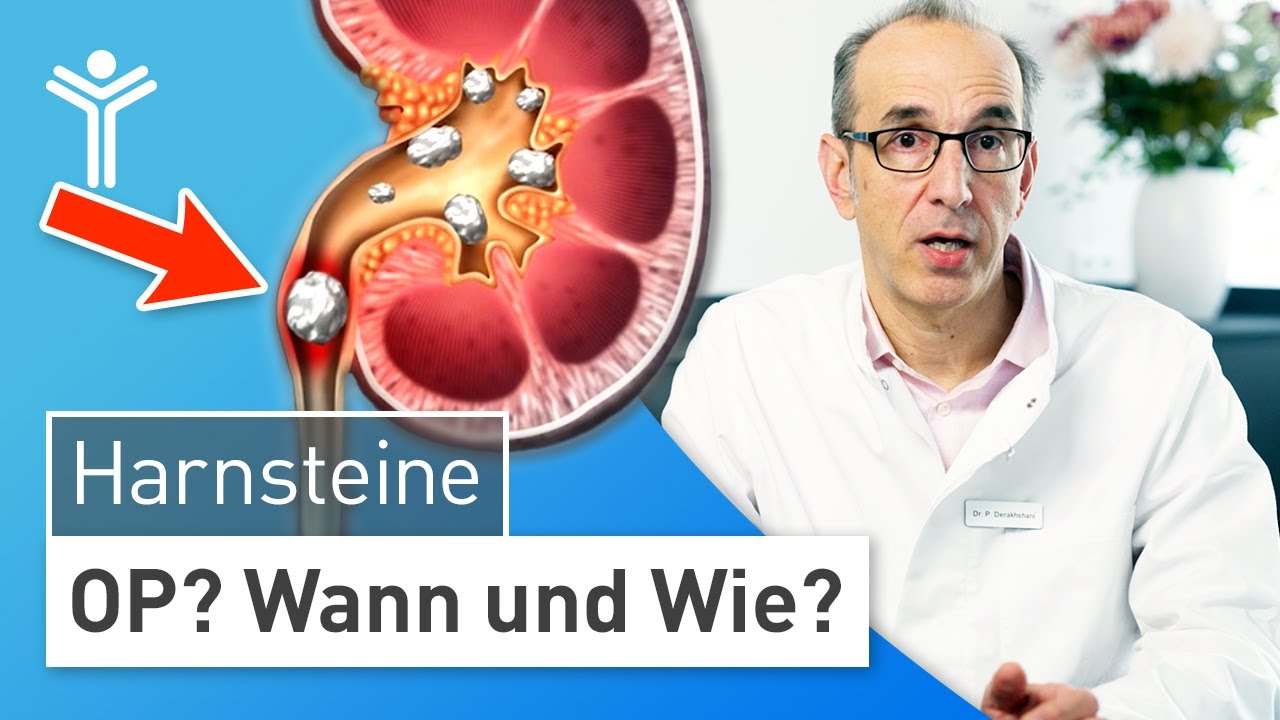 Harnsteine entfernen: WANN und WIE operieren? | Nierensteine - YouTube