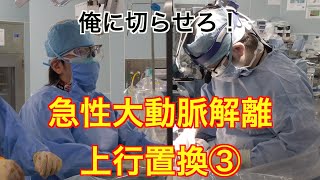 急性大動脈解離 上行置換 ③ ２時間半で終われますか？ Ascending Aortic Replacement for Acute Aortic Dissection 【俺に切らせろ！】