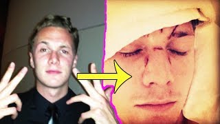 Paris Hilton's brother beaten up by Lindsay Lohan's friend in Miami