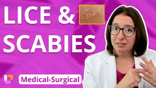 Lice & Scabies; Parasitic Infections: Integumentary System - Medical-Surgical  | @LevelUpRN