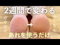 【美容】ガサガサのかかとが生き返った方法
