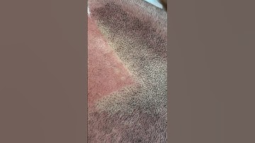 How “REAL” Can SMP look!        #scalpmicropigmentation