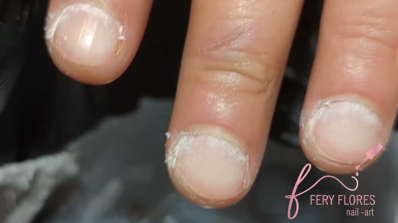 Preparación de uña natural en uñas mordidas ✨ | Mucha cutícula 