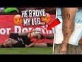He Broke My Leg At KSI's Soccer Event (serious injury)