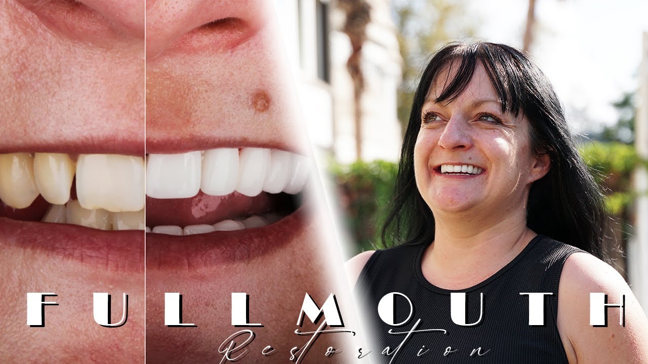 Full Mouth Restoration / Testimonial YouTube