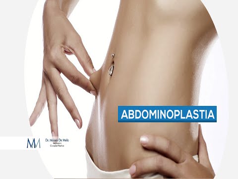 Dr. Moises De Melo | Abdominoplastia