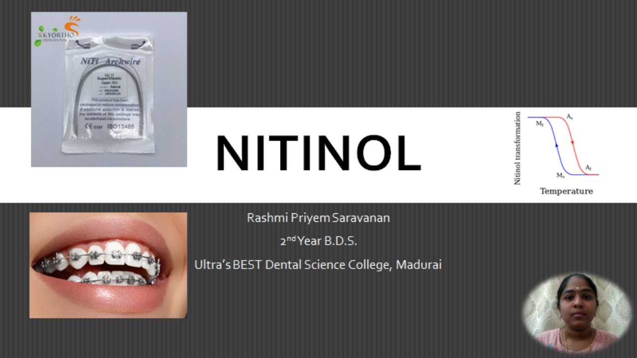 Nitinol Significance Shape Memory Orthodontic Wire Alloy