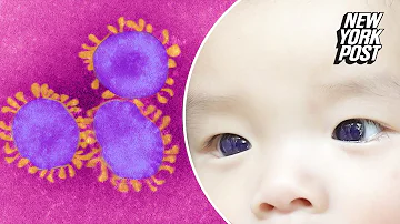 Infant’s dark brown eyes turn bright blue overnight after COVID-19 treatment