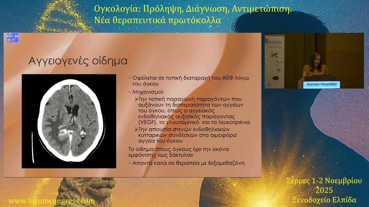 Κεφαλαλγία σε πρωτοπαθείς-δευτεροπαθείς χωροκατακτητικέςεξερασίες εγκεφάλου Ελισσάβετ Τσαγγαλίδου