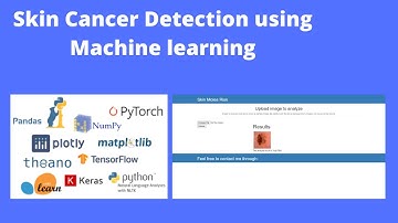 Skin Cancer Detection using Machine Learning with Source Code