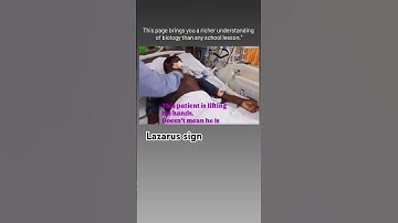 The Lazarus sign is a rare reflex movement that occurs in patients who are brain-dead. #biology #edu