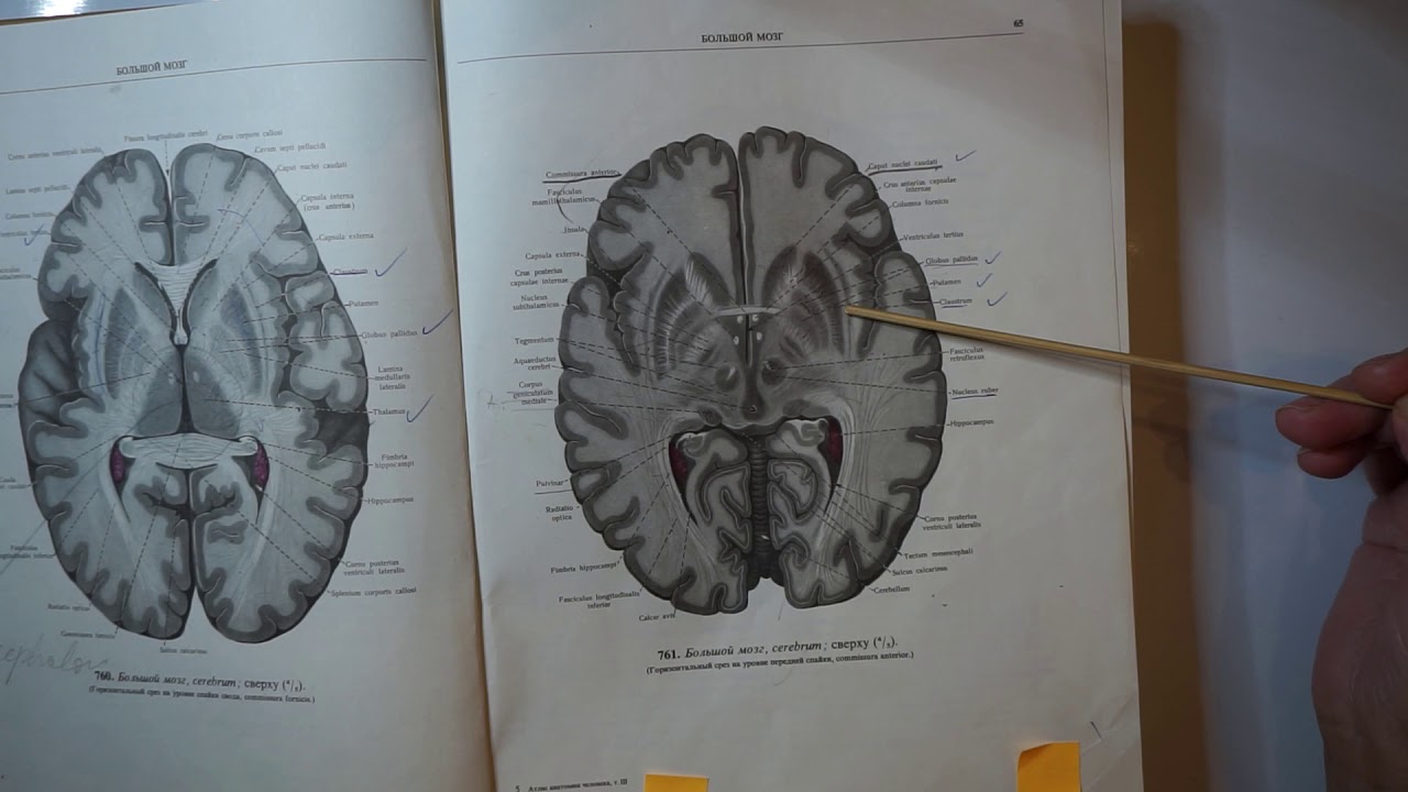 Telencephalon - siva i bijela masa, putevi, liqour i vaskularizacija | Predavanje iz AiF