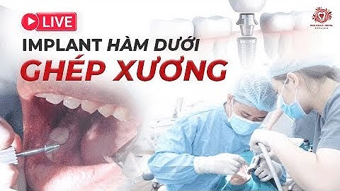 Trực Tiếp Quá Trình Cấy ghép Implant Răng Hàm Dưới Có Ghép Xương| Nha khoa Đặng Xá - S-Dental