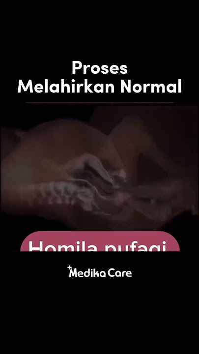 Proses Melahirkan Normal - Medikacare