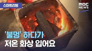 [스마트 리빙] '불멍' 하다가 저온 화상 입어요 (2020.12.21/뉴스투데이/MBC)