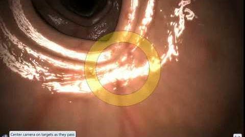 EndoSim Fundamental Endoscopy Skills 1: Knob Handling