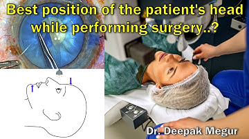Chin and Forehead position while doing surgery (FAQ series Ep.02) - Dr. Deepak Megur