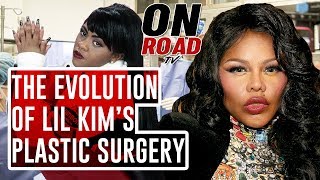 The Evolution of Lil Kim’s Plastic Surgery