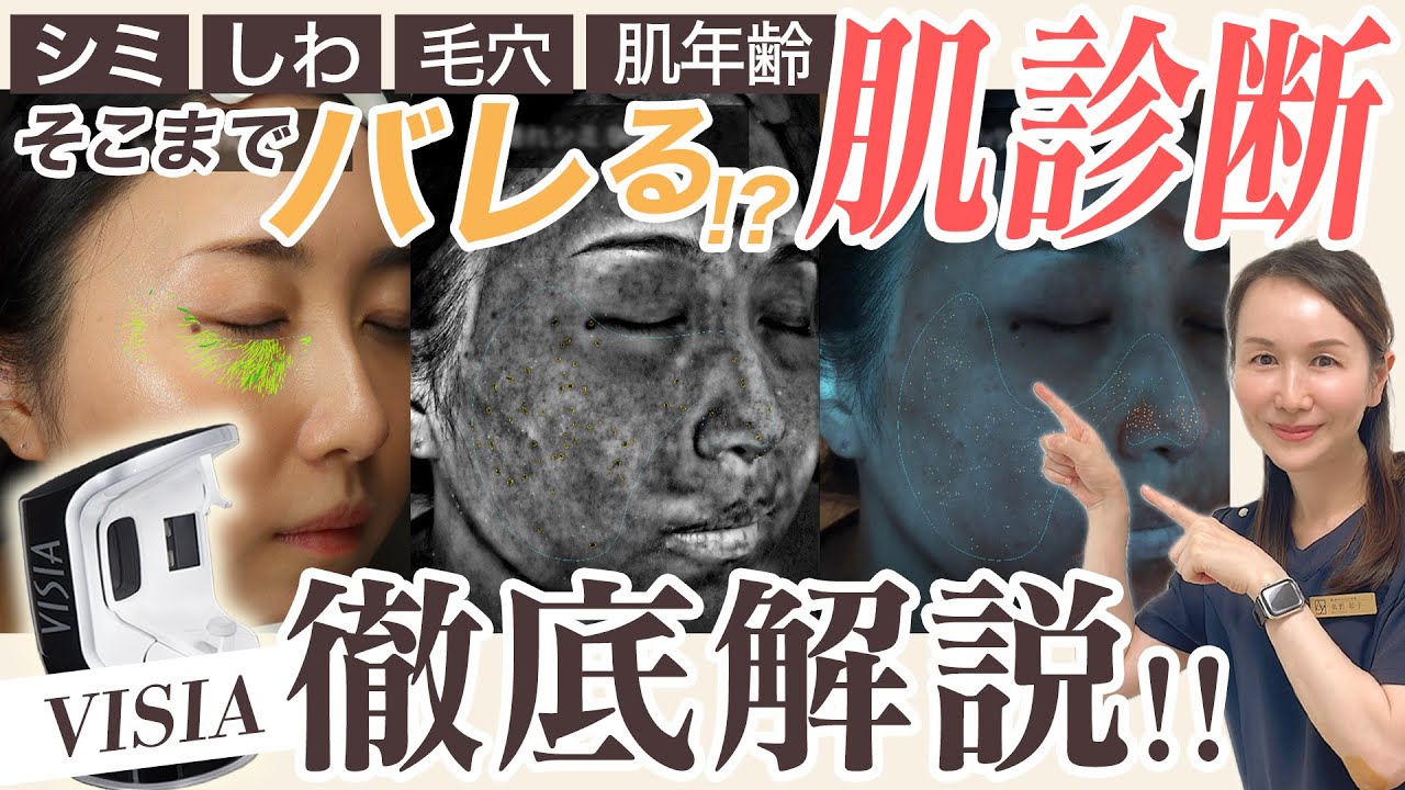 肌診断】肌の全てがわかる!?最新マシン「VISIA」と結果に合わせた