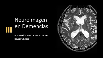 ¿Se puede ver la demencia en una resonancia magnética?