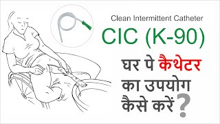 CIC (K-90) घर पे कैथेटर का उपयोग कैसे करें ?  Clean Intermittent Catheter #chhattisgarh #raipur