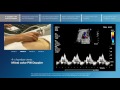 Advanced screening views of the fetal heart - Part 1 - 4-chamber color and PW Doppler