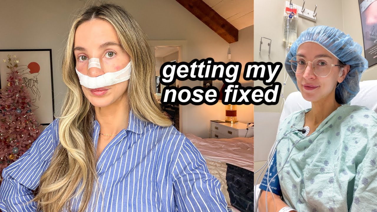 got my nose fixed then life fell apart | VLOG